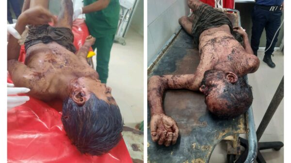বগুড়ায় ঘরে ঢুকে সন্ত্রাসী হামলায় ২ জন গুরুতর আহত