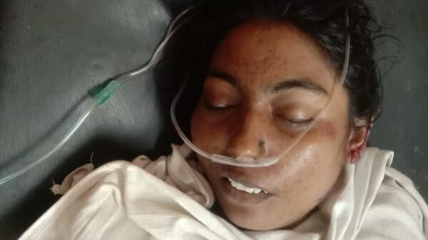 বগুড়ায় সরিষার মিলে জড়িয়ে নারী শ্রমিক নিহত