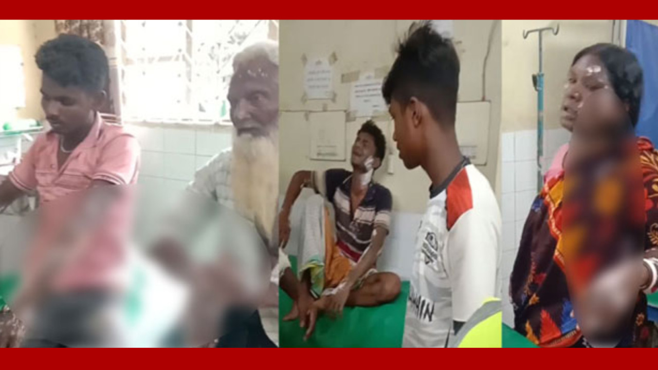 গোদাগাড়ীতে গ্যাসের বেলুন বিস্ফোরণে ৭ জন গুরুতর দগ্ধ